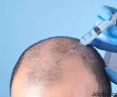 Best Dermatologist for Hair Loss