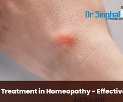 Get the Effective Homeopathic Medicine for Lipoma