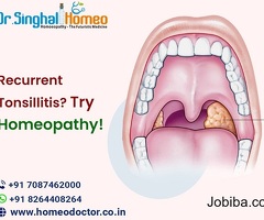 Why Homeopathic Treatment for Tonsillitis is Safer than Traditional Medicine?