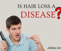 Is Hair Loss A Disease?