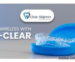 VClear Aligners