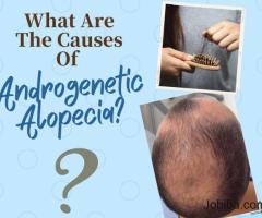 What Are The Causes Of Androgenetic Alopecia?