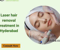 Laser hair removal treatment in Hyderabad
