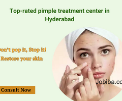 Top-rated pimple treatment center in Hyderabad