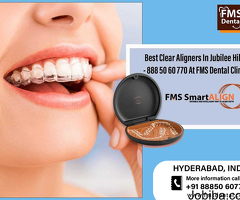 Best Clear Aligners In Jubilee Hills - 8885060770 At FMS Dental Clinic