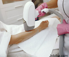laser hair removal in Hyderabad