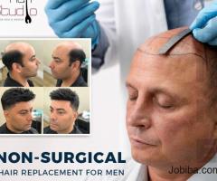 Hair Replacement services for men