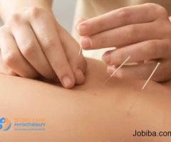 Acupuncture and Physical Therapy in Langley
